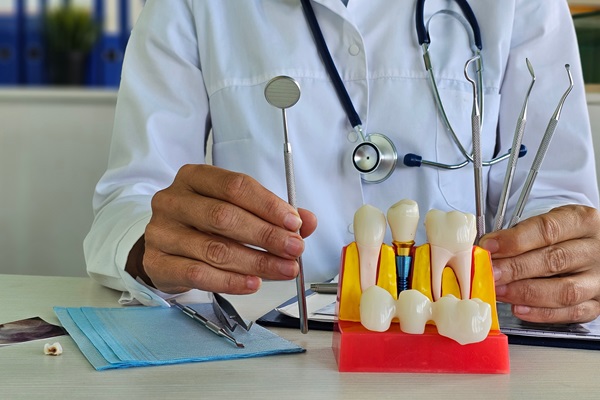 Caring For Your Dental Crown: Tips For Long Term Maintenance