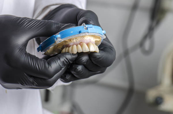 Common Questions And Answers About Implant Supported Dentures