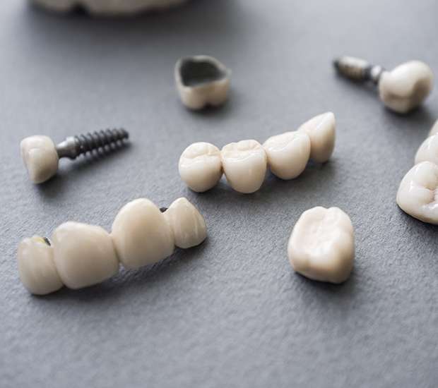 Long Beach The Difference Between Dental Implants and Mini Dental Implants