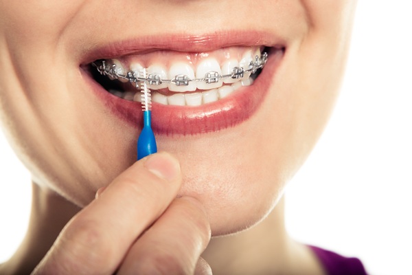 Receiving Traditional Braces From A General Dentist